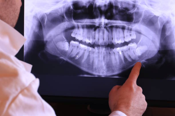 Best Orthodontic Emergency Dentist in Lecanto, FL