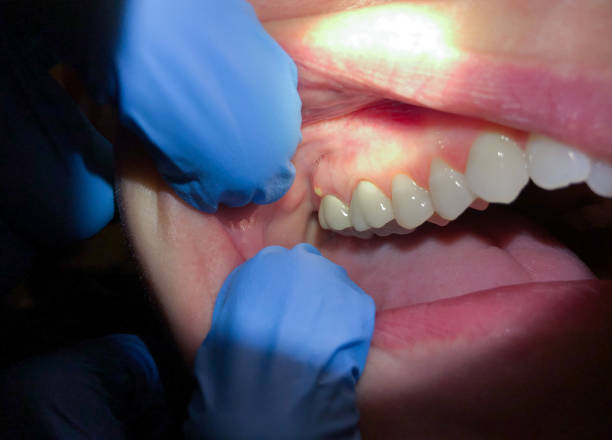 Best Mobile Emergency Dentist in Lecanto, FL